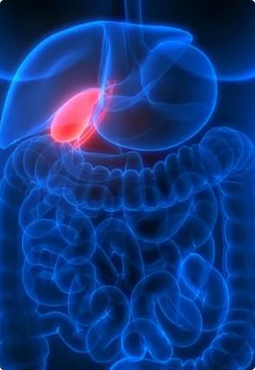 Imagen de vesícula biliar